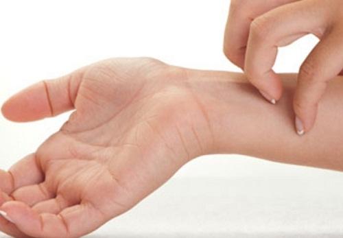 Ефірні олії для нігтів - сильний алерген для організму